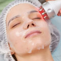 Understanding Radiofrequency Therapy: A Comprehensive Guide to Skin Tightening Treatments