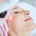 All You Need to Know About Laser Resurfacing