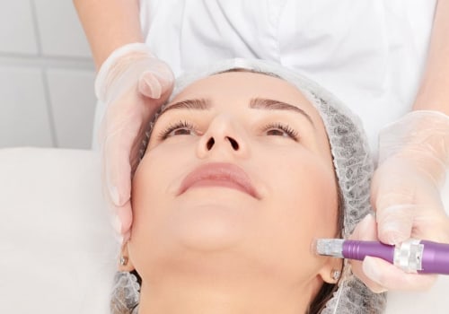 A Comprehensive Look at Microdermabrasion: A Guide to Understanding This Popular Facial Treatment