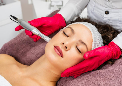 Understanding the Benefits and Procedures of Microneedling