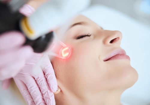 All You Need to Know About Laser Resurfacing